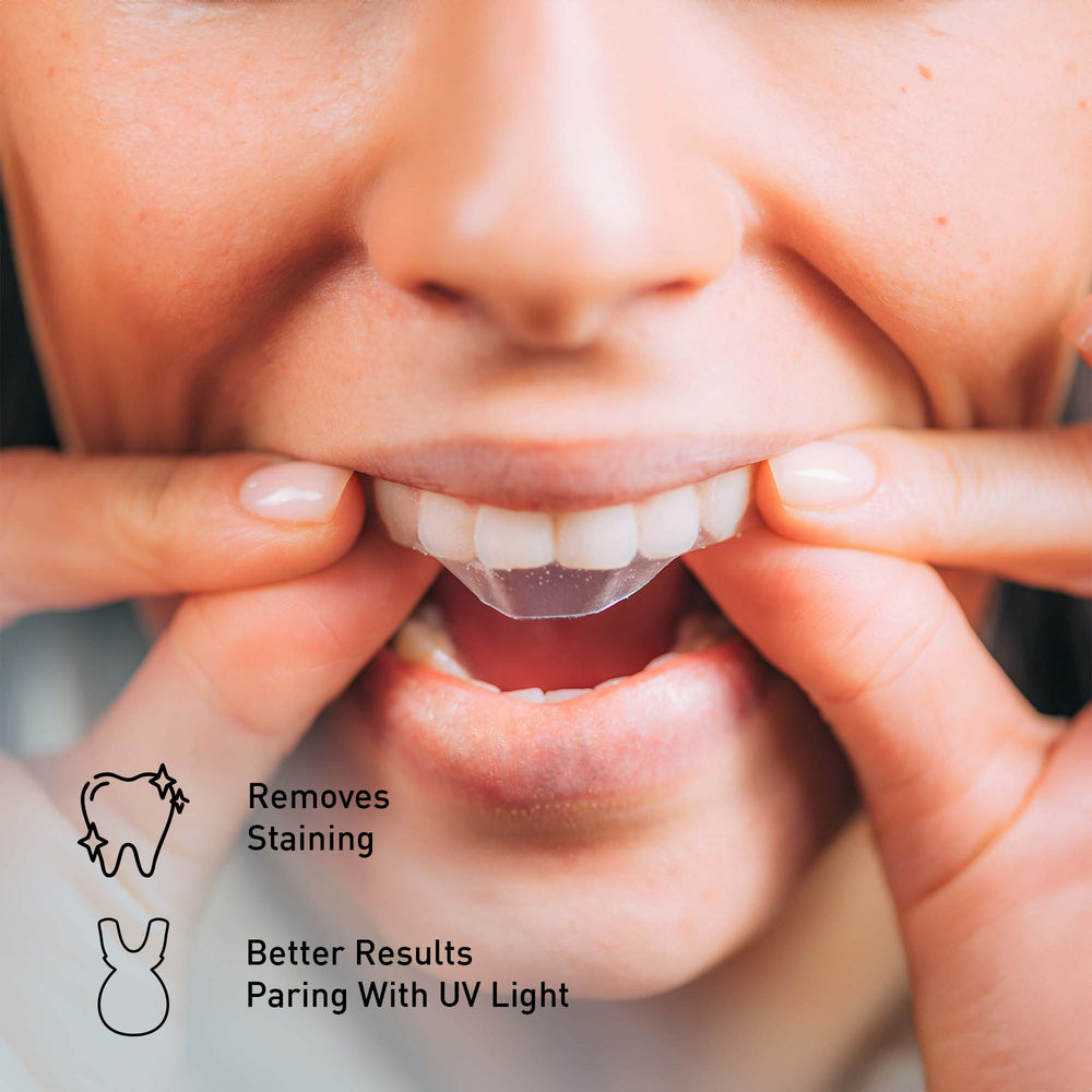 Close-up of a person holding their mouth open with text about teeth whitening and UV light.