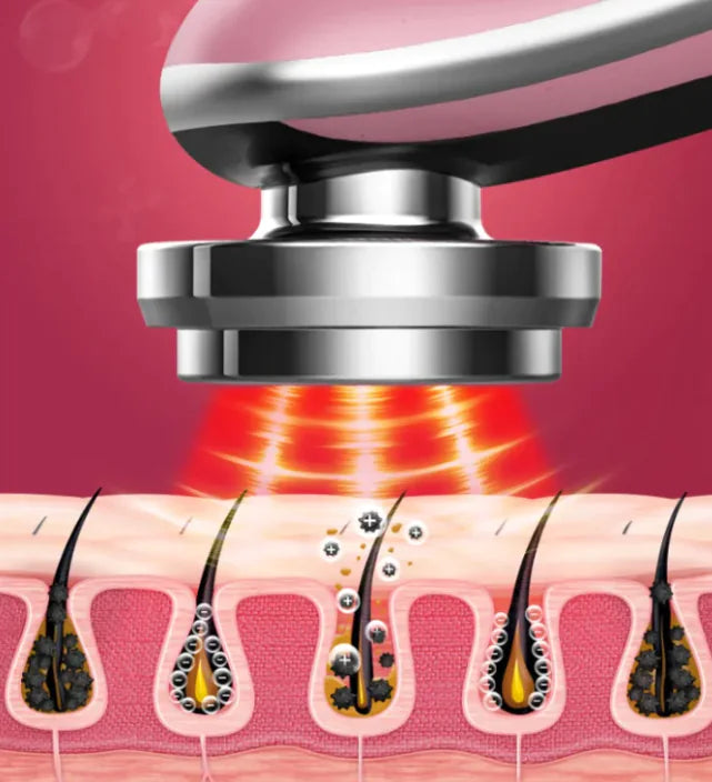 Illustration of a hair removal device targeting hair follicles on skin.