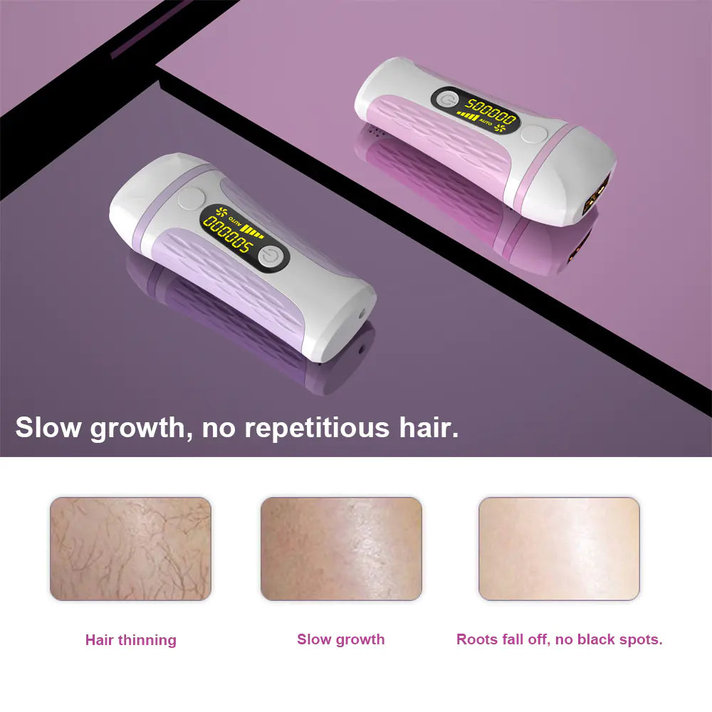 IPL Laser Hair Removal Device for Home Use (Unisex)
